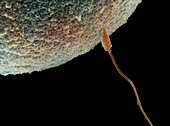 Single Sperm Penetrating an Egg