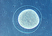 Fertilized sea urchin egg