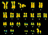 Coloured LM of chromosomes of a normal human male