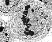TEM of metaphase cell division of a HeLa cell