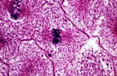 Early metaphase of mitosis,LM