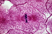 Late metaphase of mitosis,LM
