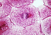 Middle anaphase of mitosis,LM