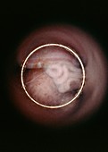 Human foetus: stomach,intestine,umbilicus