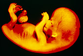 Human foetus after 56 days development