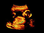 Colour ultrasound scan of 16-week-old human foetus