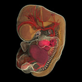 44-day-old Embryo (Micro-MRI)