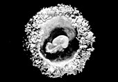 Human embryo at 28 days old