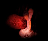 22-day-old human embryo,MRI scan
