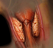 Parathyroid Glands