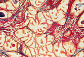 Light micrograph of a healthy human prostate gland