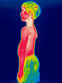 A thermogram of a boy in shorts (profile)