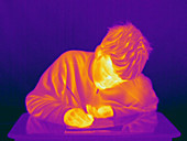 Thermogram of a Boy