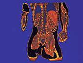 MRI of dorsal view of human figure