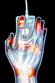 Artwork based on X-ray of hand and computer mouse