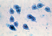 LM of Giardia lamblia parasitic protozoa