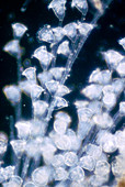 Carchesium protozoan