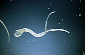 Platyhelminthes Trematoda