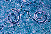 LM of the nematode,Strongyloides stercoralis