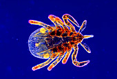LM of a Lyme disease tick nymph,Ixodes dammini