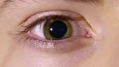 Green eye with pupil constricting
