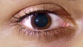 Brown eye with pupil constricting