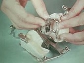 Constructing and fitting dentures, 1960s