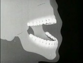 Dental health film, periodontitis
