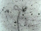 Onchocerciasis nematode roundworm