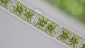 Ciliates moving on green algae filaments