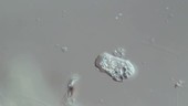 Amoeba, light microscopy