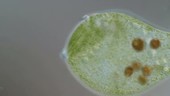 Stentor polymorphus, light microscopy