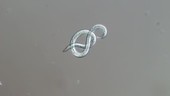 Nematode roundworm, light microscopy