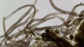 Spirostomum ciliates, light microscopy