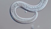 Nematode roundworm, light microscopy