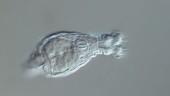 Bdelloid rotifer, light microscopy
