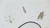 Paramecium feeding, light microscopy