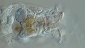 Rotifer, Brachionus sp, light microscopy
