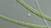 Strombilidium ciliate protozoan