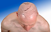 Person with cracked head,illustration