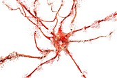 Apoptosis of a neuron,illustration