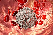 Leukaemia blood cell,illustration
