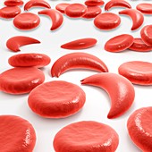 Red blood cells in sickle cell anaemia