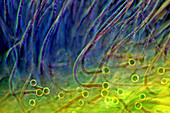 Rivularia cyanobacteria,light micrograph