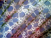 Apple stem,light micrograph