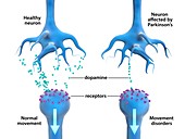 Parkinson's disease,neurons and dopamine