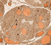 Pancreatic acinar cells,TEM