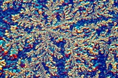 Dried human tear,light micrograph