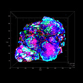 Breast cancer hypoxia, 3D tomography