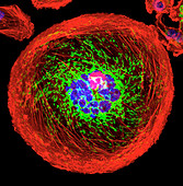 Polyploid giant cancer cell from breast